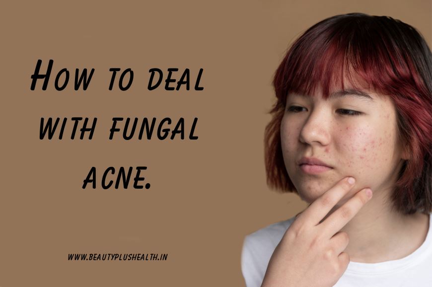 How to deal with fungal acne